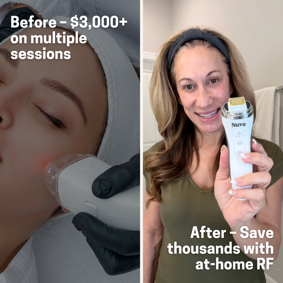 Nuve Radiance 16 Nuve Radiance